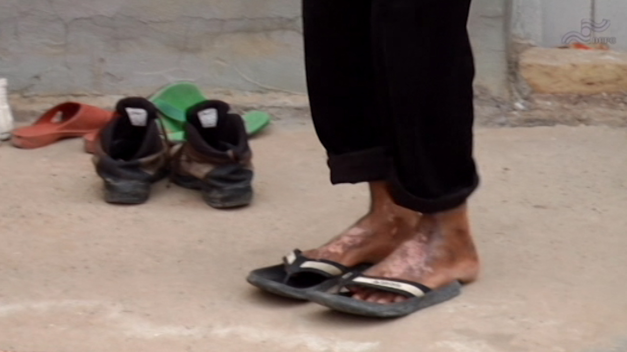  فیلم سینمایی از نفس افتاده ها به کارگردانی عباس امینی